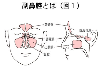 好 酸 球 性 副 鼻腔 炎